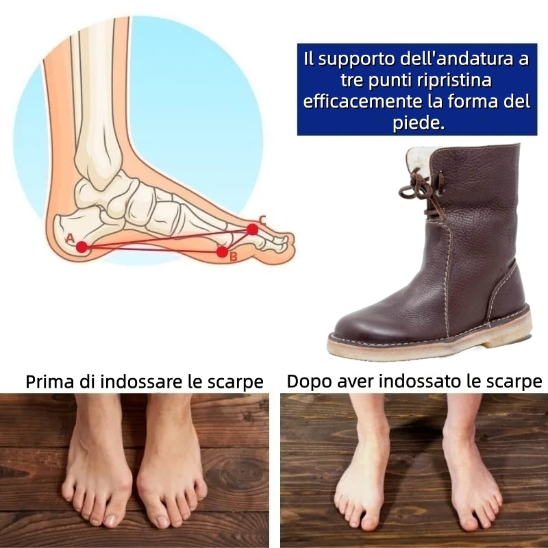 (🎉 Offerta speciale di oggi: 70% di sconto - Non perdertela!) ⏰ Scarpe invernali ortopediche ergonomiche che alleviano efficacemente il dolore a piedi, ginocchia e schiena. ✅ Calde scarpe ortopediche progettate specificamente per le donne europee.