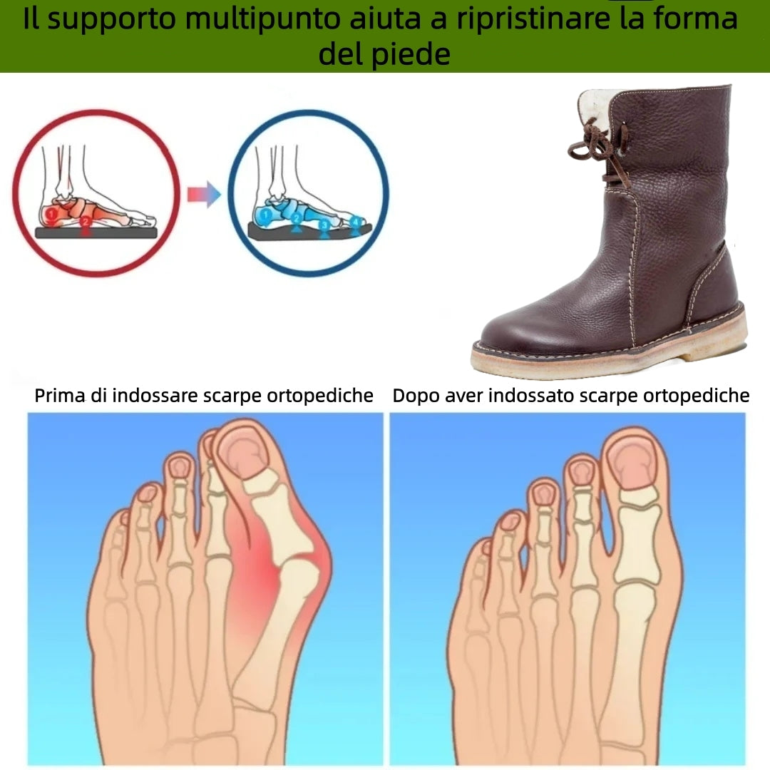 (🎉 Offerta speciale di oggi: 70% di sconto - Non perdertela!) ⏰ Scarpe invernali ortopediche ergonomiche che alleviano efficacemente il dolore a piedi, ginocchia e schiena. ✅ Calde scarpe ortopediche progettate specificamente per le donne europee.